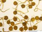 Mannia triandra (Scop.) Grolle